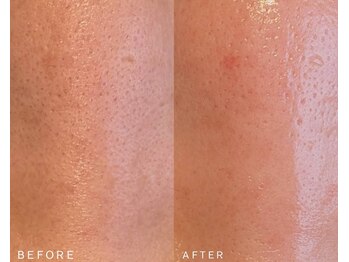 ブリリア モア(Brillia Moi)/フェイシャル