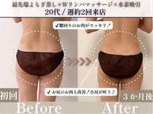 ヨサパーク ココ(YOSA PARK COCO)の雰囲気（水素&ハーブミストで全身体力発汗！お肌もツルツルになります♪）