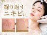 【毛穴/皮脂/アクネ菌へ】ニキビ根本改善！プラズマ×ハーブピーリング