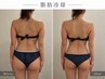 【再来・6週間以内】脂肪冷却4カップ集中ケア ￥17,600