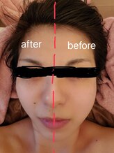 ビハーラ 門司店/【人気No.2】ボディー＋顔筋