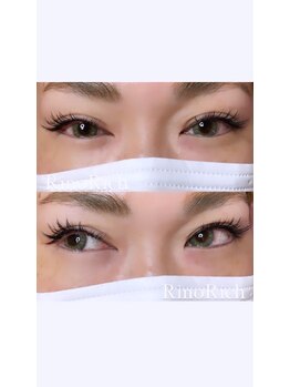 リノリッチ(RinoRich)/バインドロック☆