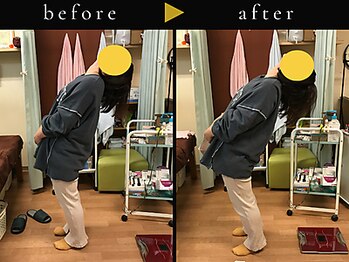 杉本接骨鍼灸院/若々しい背骨を取り戻す整体