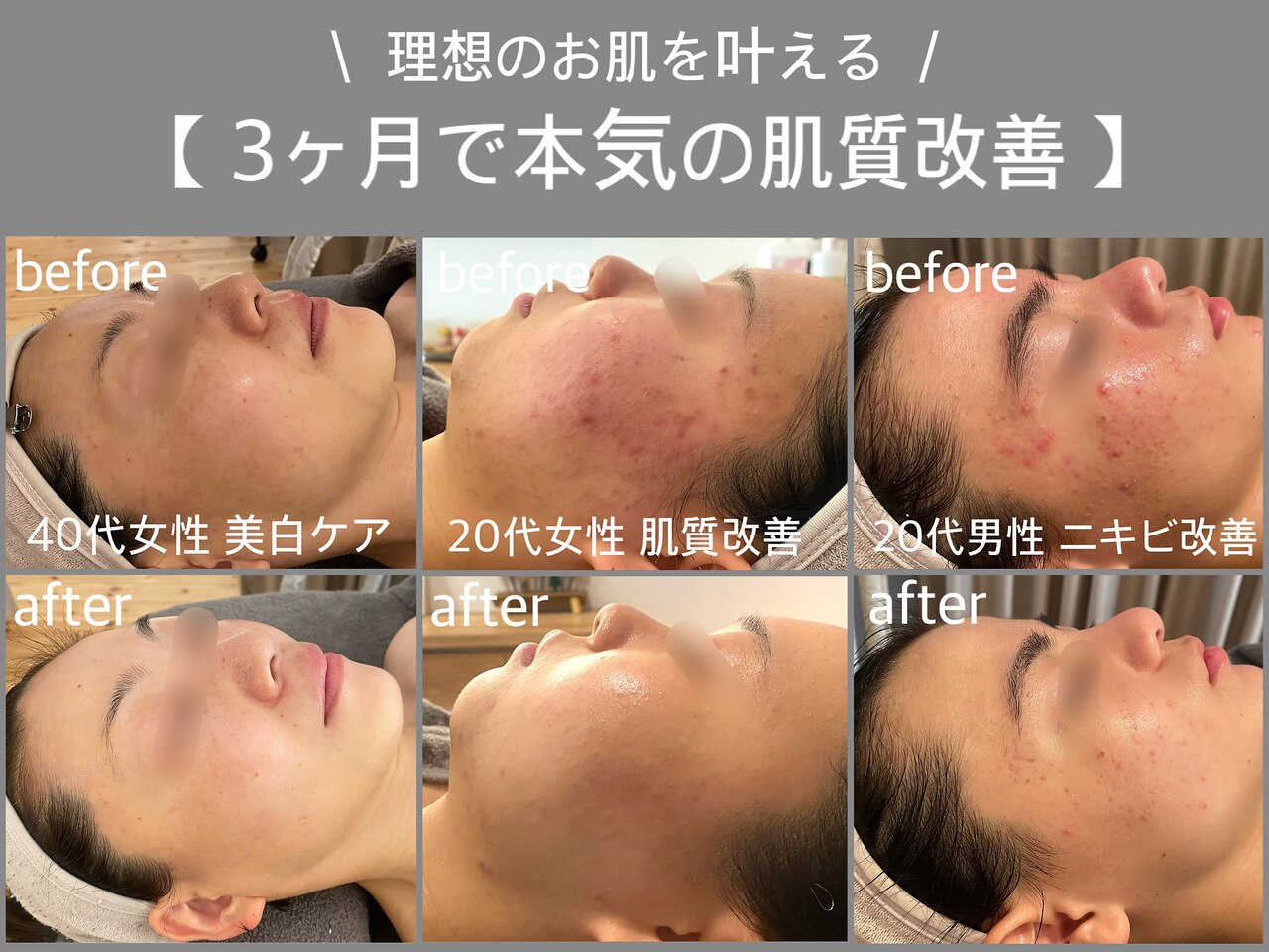 セルフでもサロンでも♪フォトフェイシャルエステ 4F エステサロンさくら ＼心もからだもリセットするひととき