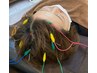 【疲労・ストレス解消】 ぐっすり快眠!頭皮を柔らかくするヘッドスパ鍼灸