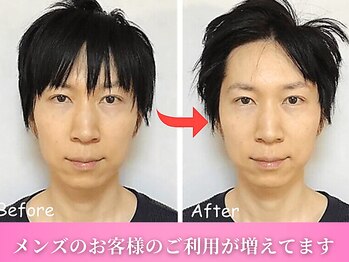 鍼灸整体院ワト 三軒茶屋院(鍼灸整体院WATO)/■メンズ小顔矯正・骨格矯正
