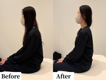 ソレア(Solea)/股関節の硬さ・猫背・首の痛み