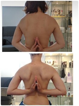 エムプリュ 心斎橋店(M.plus)/背中ケア大切☆