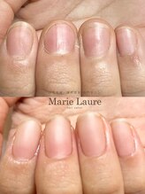 マリーロール 梅田店(Marie Laure)/自爪育成/深爪矯正/ネイルケア