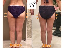 セレスティアル ビューティ アデ 岐阜南店(Celestial Beauty ADE)/ビフォーアフター☆