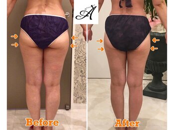 セレスティアル ビューティ アデ 岐阜南店(Celestial Beauty ADE)/ビフォーアフター☆