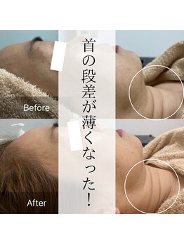 キーオブフェイス(Key of Face)/首の線！滑らかに～♪