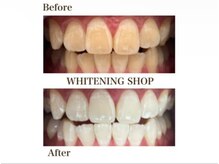 ホワイトニングショップ 米子店の雰囲気（照射中スマホ使用可能。隙間時間を活用しながらホワイトニング。）
