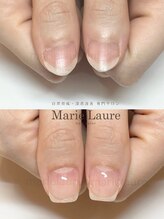 マリーロール 淀屋橋本店(Marie Laure)/自爪育成/深爪矯正/ネイルケア