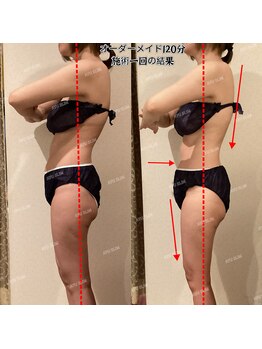 アユスリム(AYU SLIM)/一回でも変化できるの充実痩身