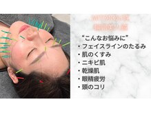 ミトノウ(MITONOU)/美容整体MITONOU（整体/美容鍼）