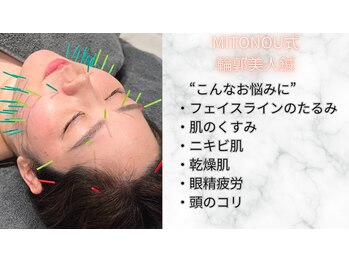 ミトノウ(MITONOU)/美容整体MITONOU(整体/美容鍼)