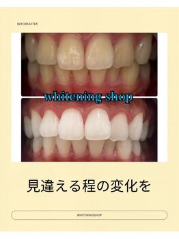 ホワイトニングショップ 葵区静岡駅店/ホワイトニング店ホワイトニング
