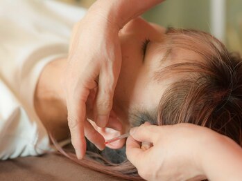 はるもにあ/美容鍼