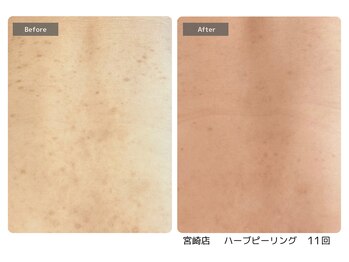 エミルカ 宮崎店(EMILUCA)/プールや温泉でも恥ずかしくない