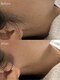 オスロ温サロン(OSLO.温salon)の写真/《フェイシャルワックス+エステ》肌ケアしながら産毛のない毛穴レスなもちもち＆うるツヤ美肌へ導きます♪