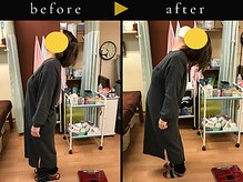 杉本接骨鍼灸院/若々しい背骨を取り戻す整体