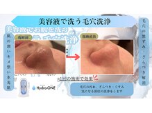 ティー(T)/ハイドラフェイシャル