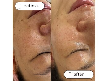 ソルズ(sol'z)/ミコステラ