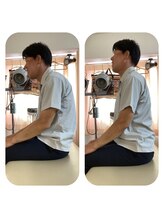 ハンズ治療院 東中野院/「姿勢矯正の症例」