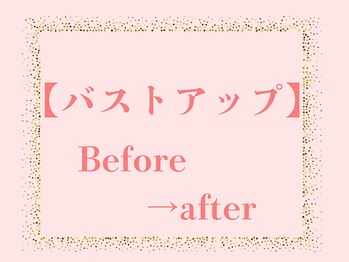 ローズルート(Rose route)/バストアップBefore→After
