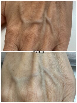 サナ 久が原 千鳥町(S’ana)/ルビッシュ照射