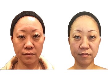 小顔整体研究所 KSラボ 藤が丘店/