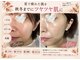エヌ(N)の写真/夏の紫外線に疲れたお肌を
ツヤ肌、ハリ復活フェイシャル