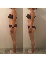 ピカケ(PIKAKE)/筋膜リリース