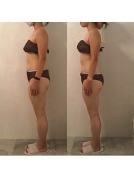 ピカケ(PIKAKE)/筋膜リリース