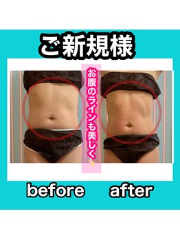 ビューティ ウィッチ(Beauty Witch)/お腹のラインを美しく