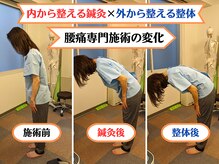 マッチ鍼灸整骨院の雰囲気（鍼灸×整体の併せ技！腰痛肩こり手足のシビレや頭痛も対応！）