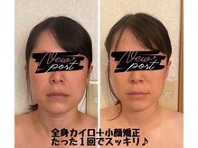 カイロプラクテックサロンドアール(Salon de R)の雰囲気（広島で大流行!!小顔矯正☆もちろん姿勢矯正も一緒に！）