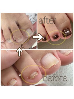 クランベリーネイル 代官山 恵比寿(cranberry nail)/巻き爪対応メニューあります