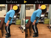 杉本接骨鍼灸院/若々しい背骨を取り戻す整体