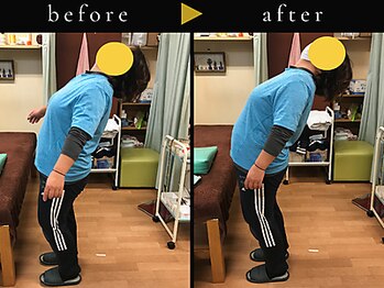 杉本接骨鍼灸院/若々しい背骨を取り戻す整体