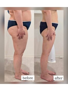 リアージュ(Riage)/お客様の変化