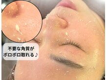 ルナビューティー(LUNA BEAUTY)の雰囲気（韓国ピーリング/くすみ改善ワントーンUP/小顔リンパマッサージ）