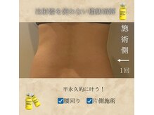なごみの雰囲気（【何しても痩せない方！】天然成分オーガニック製剤の脂肪分解液）