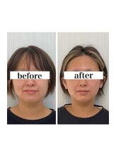 キュープ 名張店(Qpu)&nbsp;人気No,２ フルコース