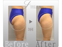 ステラ(STELLA)/下半身プレミアムの効果