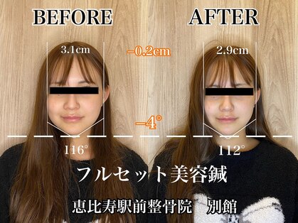 恵比寿駅前整骨院はり院 別館の写真