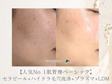 アネラボーテ(Anela Beaute)/どんな肌悩みにも対応◎