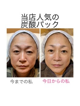 マックス(MAX)/違いがわかりますか?