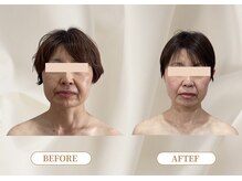 トロワ(TROIS)/つるんとしたおでこの秘密